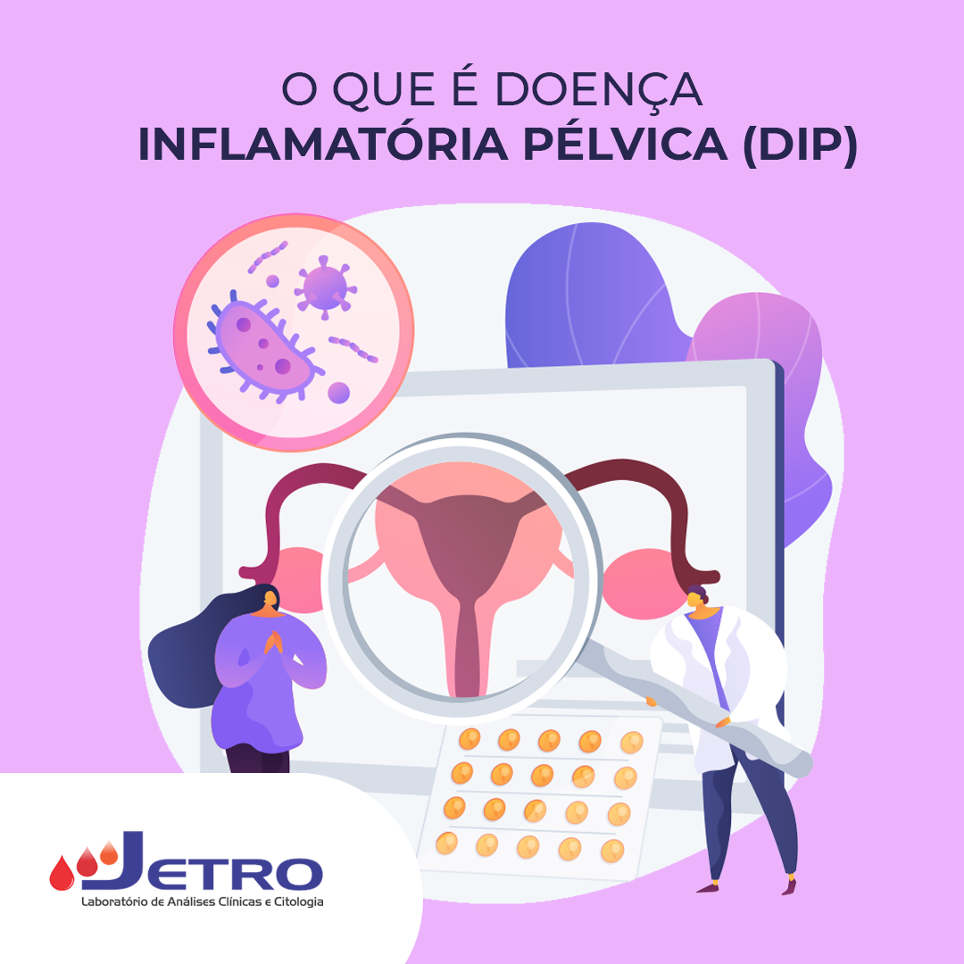 O que é doença inflamatória pélvica?